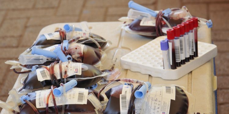 Uganda runs out of blood, multiple deaths related to shortages reported during Covid-19 lockdown