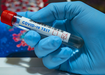 Gov’t plans to curb the high cost of COVID testing