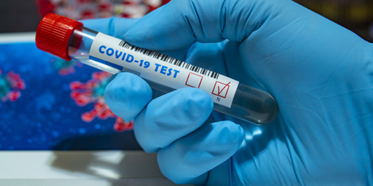 Gov’t plans to curb the high cost of COVID testing