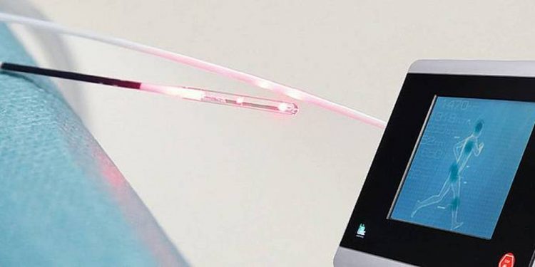 Laser technology poised to change surgeries in Uganda